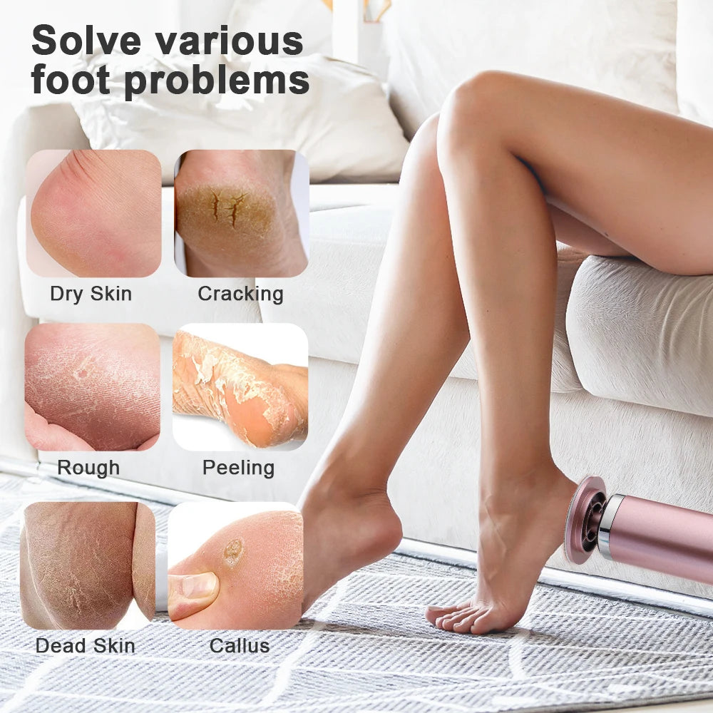 VelvetFeet™ Callus Wiper Pro