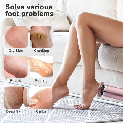 VelvetFeet™ Callus Wiper Pro
